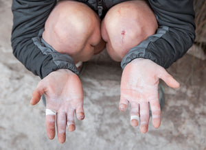 Person holding out their hands palm up, chalk and tape on their fingers